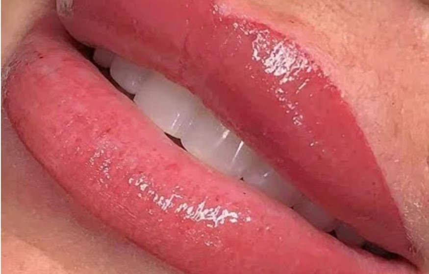 Maquillage permanent des Lèvres - Candy Lips 